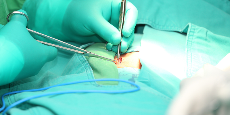 Operasi hernia dilakukan dengan prosedur operasi terbuka