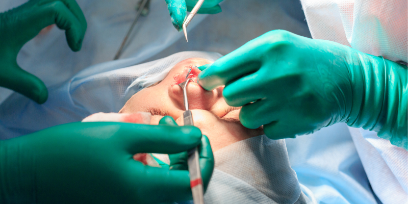 Operasi plastik untuk pembedahan konstruksi dan kosmetik