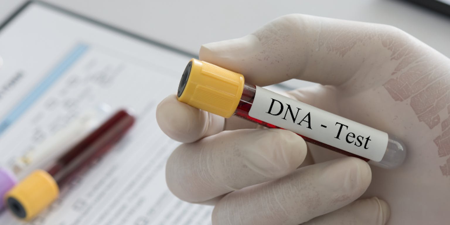Biaya Tes DNA di Rumah Sakit Terbaru? Ini Rinciannya!
