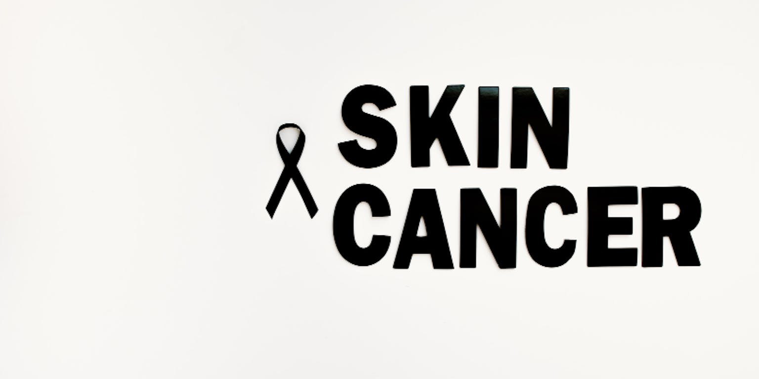 jenis-jenis kanker kulit